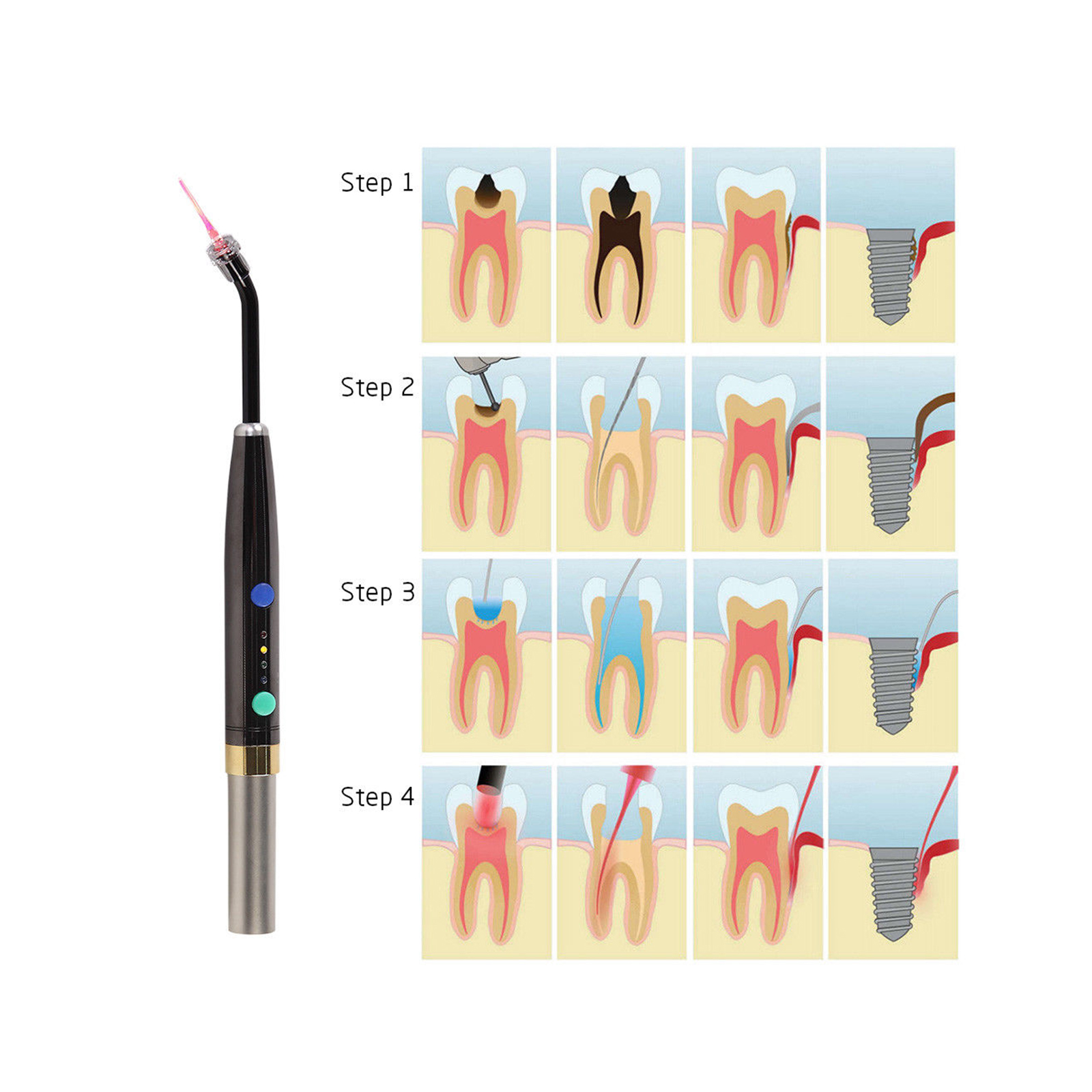 Dental Laser Diode System Cord - Industrial Laser Diode avaliação e preço